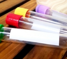Test Tube Label