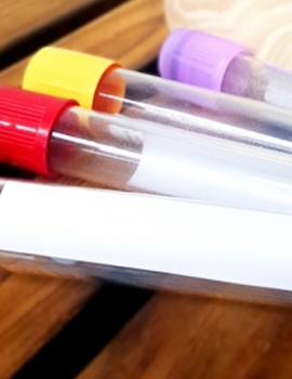 Test Tube Label