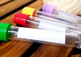 Test Tube Label